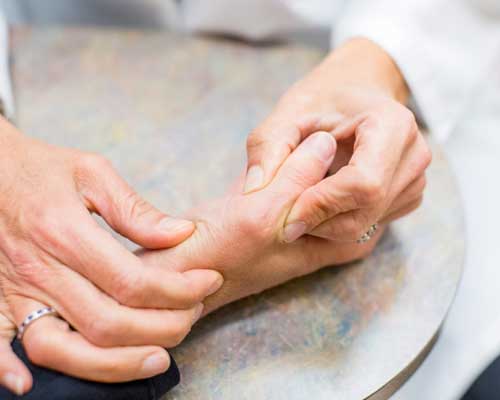 ligament